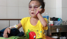 Bé 4 tuổi bị đánh: Thêm thông tin rùng mình về đôi vợ chồng ác quỷ